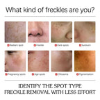 Dark Spots Removal Cream Facial Whitening Freckle Acne Mark Pigmentation Removal Melanin Skin Correction Brighten Care Products