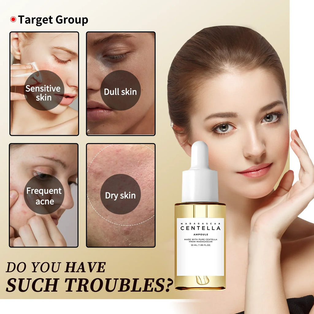 55ml Centella Asiatica Serum - Intense Hydrating, Acne Reduction, Skin Soothing & Brightening for Sensitive, Dull, Dry Skin