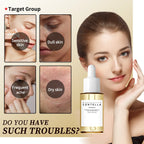 55ml Centella Asiatica Serum - Intense Hydrating, Acne Reduction, Skin Soothing & Brightening for Sensitive, Dull, Dry Skin