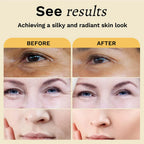 2pcs Tumeric Dark Spots Toner Spots Eraser Corrector Turmeric Fade Blemishes Dark Spot Remover Acne Remover Toner for Dark Skin