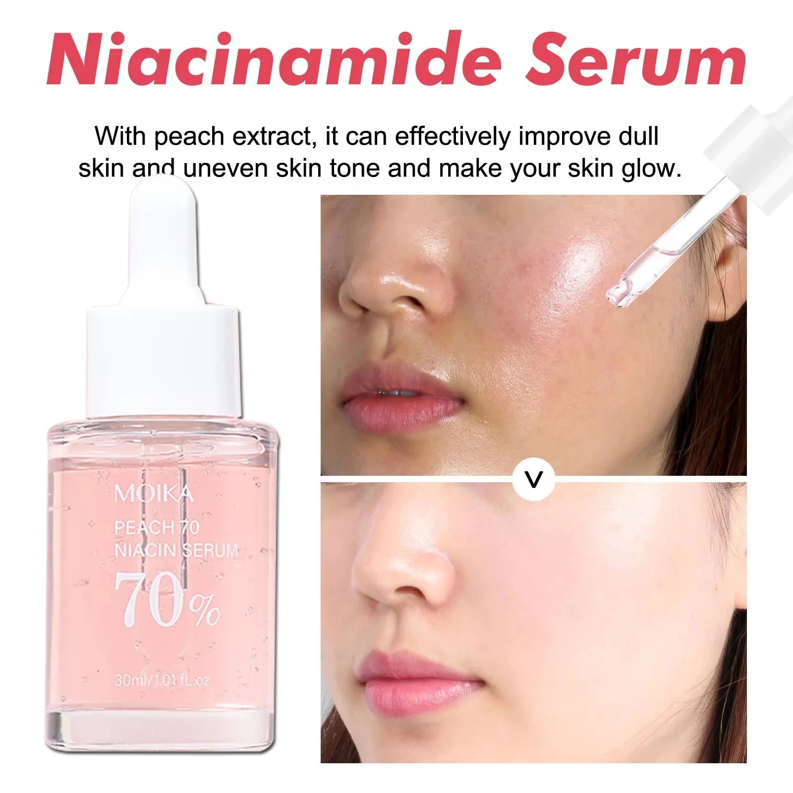 Niacinamide Serum Dark Spot Remover Fade Acne Marks Hyperpigmentation Shrink Pores Even Skin Tone Moisturizing Korea Skin Care