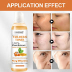 2pcs Tumeric Dark Spots Toner Spots Eraser Corrector Turmeric Fade Blemishes Dark Spot Remover Acne Remover Toner for Dark Skin